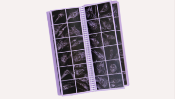 Denzer book - skin cells